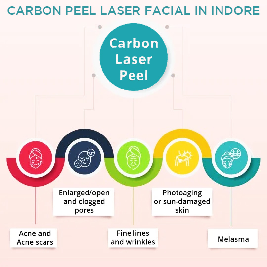 What Concerns can be Addressed by Carbon Laser Peel Treatment In Indore?